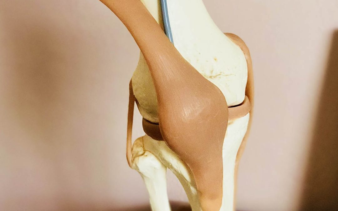 What Makes The Conformis Custom Knee Different Than The Robotic Makoplasty Knee